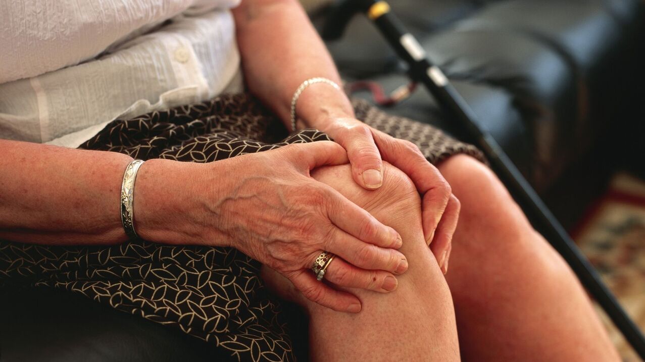 Knee arthrosis in an elderly woman