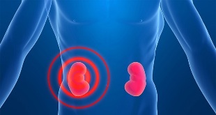 Signs of kidney pain