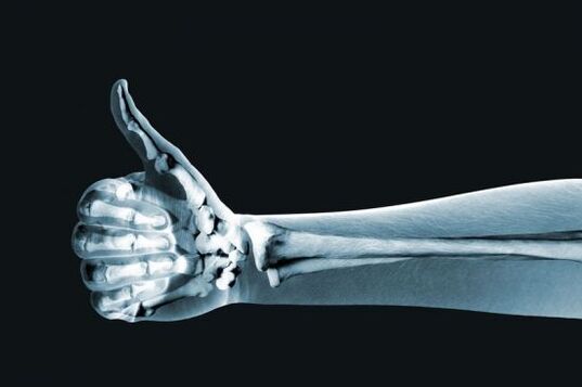 X-ray can help diagnose pain in the joints of the fingers