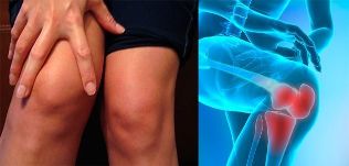 Discomfort and swelling in the knee area are the first symptoms of arthrosis